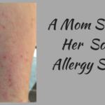Whoo’s KNOWDifferent?! A Mom Shares Her Son’s Allergy Story